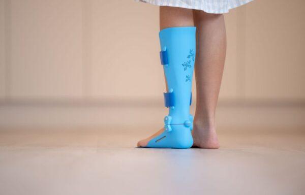 Customized Orthosis and Prosthesis